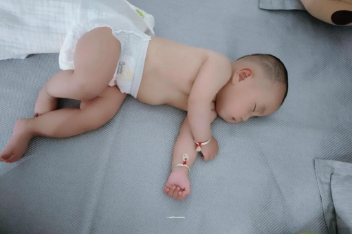 驻马店六个月宝宝眼睛散光